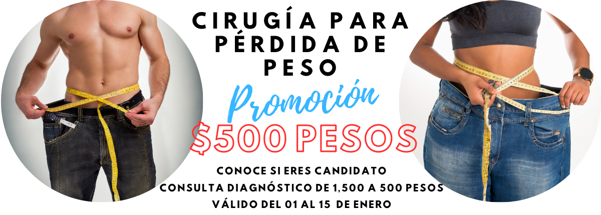 cirugia-bariatra-monterrey.png